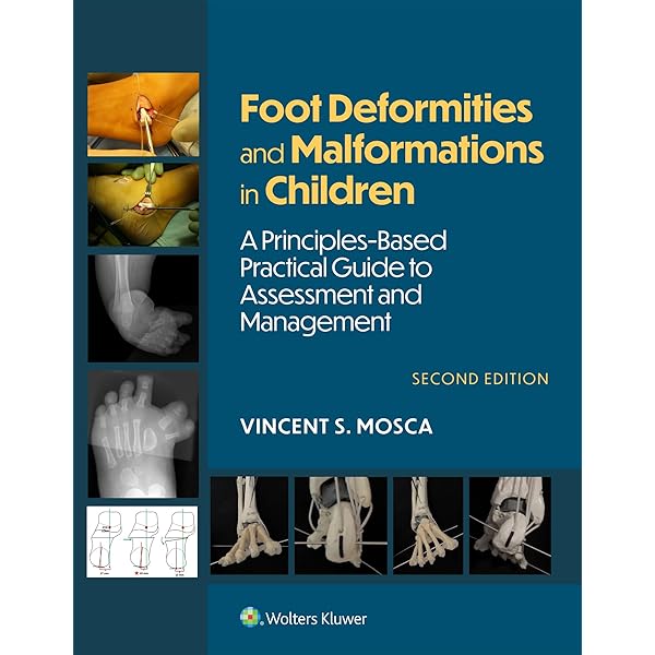 Amazon.com: Rockwood and Wilkins' Fractures in Children
